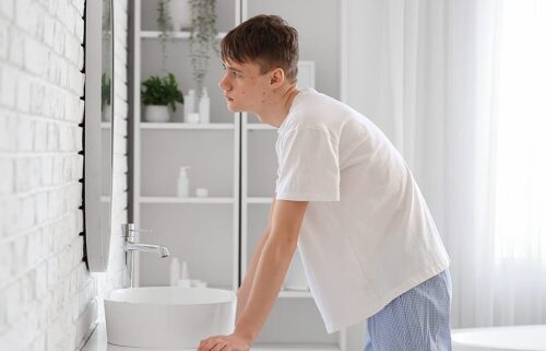 7 proven acne treatments for teens