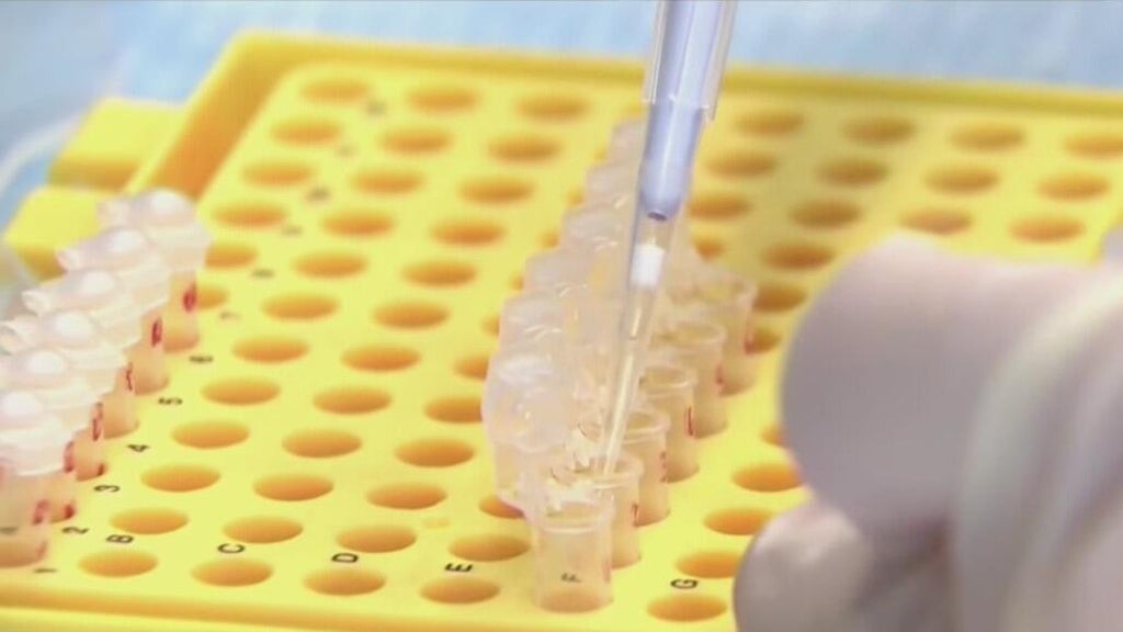 California Prop. 38 to use bond money to fund immunology research with half dedicated to one nonprofit